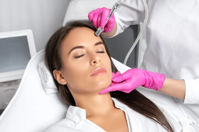 Microdermabrasion